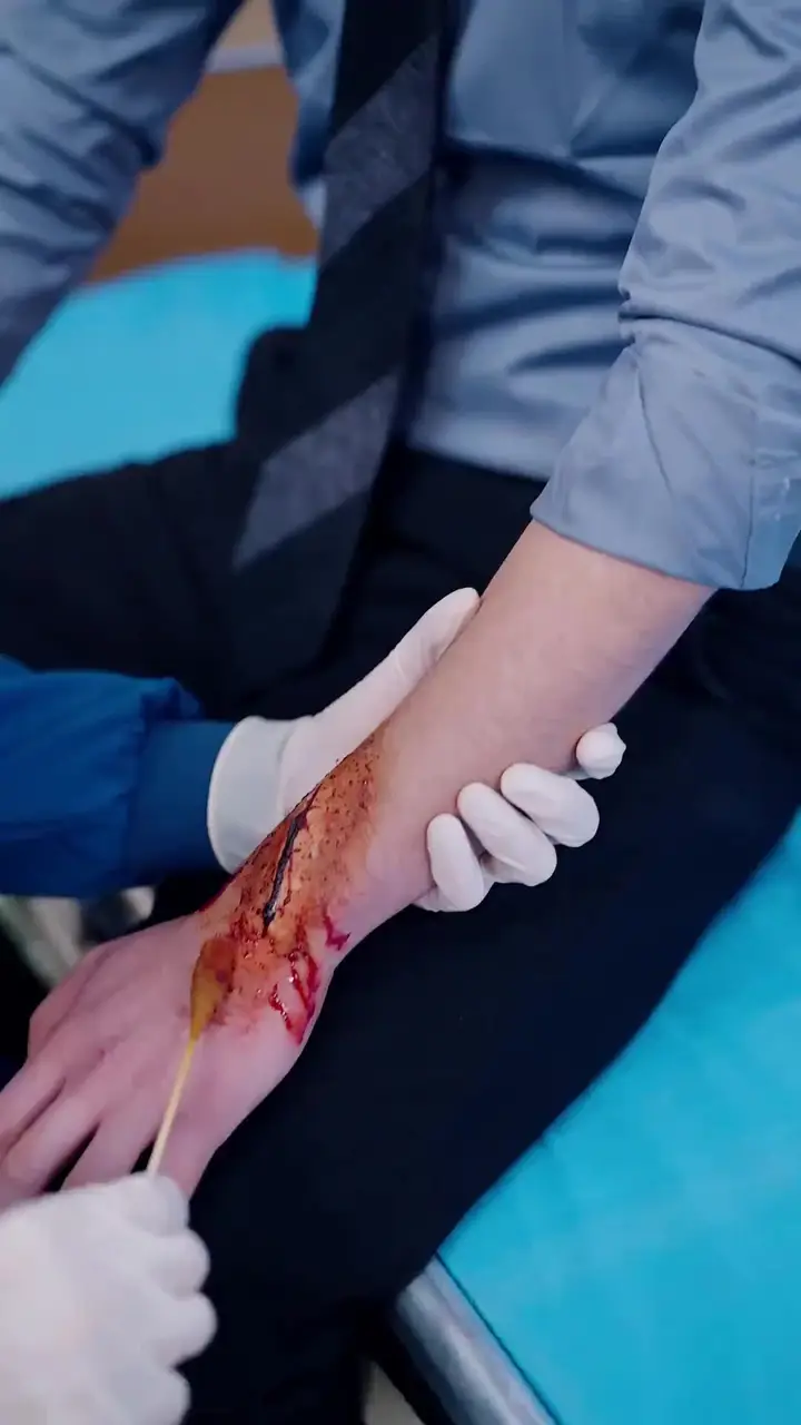(Dubbed) Wow! He Is a Brilliant Surgeon Episode 34