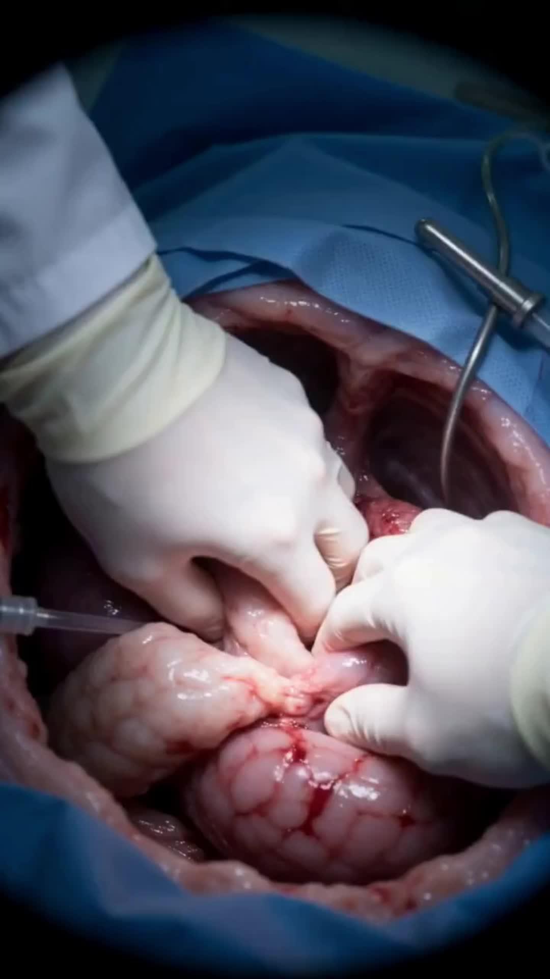 The PhD Who Couldn’t Suture